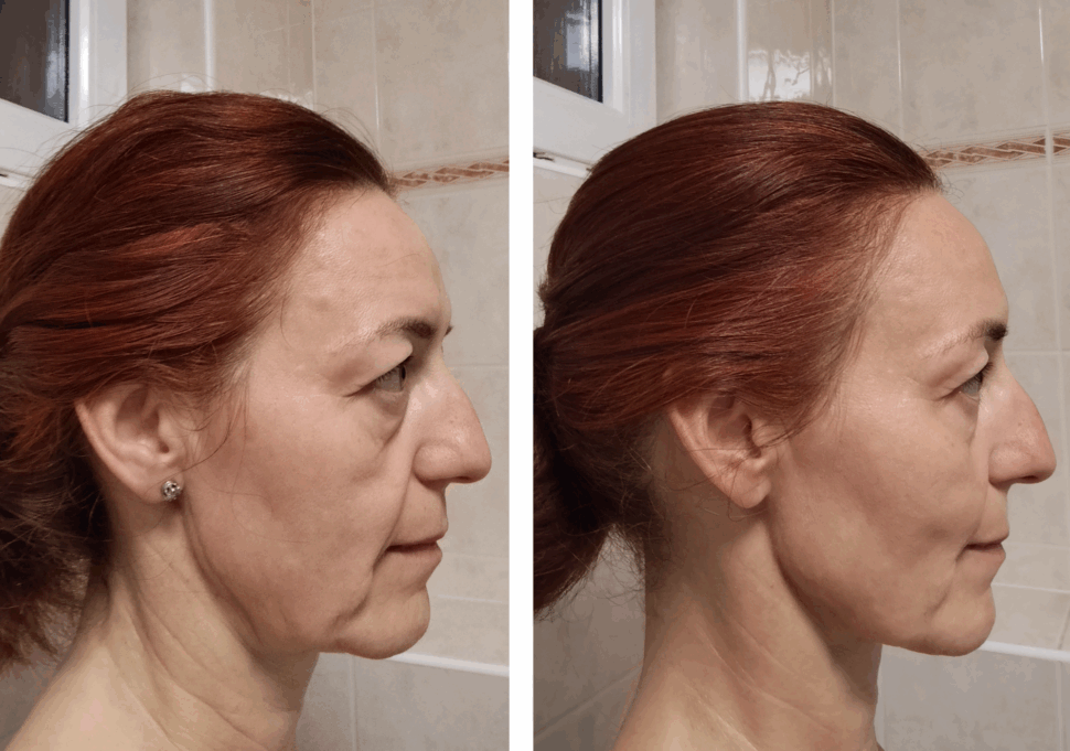 Srovnávací fotografie před a po absolvování programu Facelift Yoga Experience od certifikované lektorky Martiny Bajerové, zobrazující zpevnění kontur čelisti a svěžejší vzhled profilu tváře.