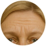Detailní záběr čela se zřetelnými horizontalními vráskami a horní částí očí, vytvořený pomocí umělé inteligence pro online program Facelift Yoga Experience od certifikované lektorky Martiny Bajerové.