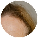 Detailní pohled na horní část čela a linii vlasů vytvořený pomocí umělé inteligence (AI) pro účely online programu Facelift Yoga Experience od certifikované lektorky Martiny Bajerové.