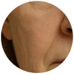Detailní AI vizualizace vrásek a textury pleti v oblasti tváří vytvořená pro online program Facelift Yoga Experience od certifikované lektorky Martiny Bajerové.