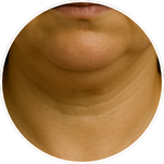 Detailní AI vizualizace oblasti brady a&nbsp;krku vytvořená pro&nbsp;online program Facelift Yoga Experience od certifikované lektorky Martiny Bajerové.
