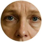 Detailní AI vizualizace horní části tváře, čela a očního okolí vytvořená pro online program Facelift Yoga Experience od certifikované lektorky Martiny Bajerové. Slouží k názorné ilustraci zaměření technik.