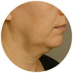 Detailní AI vizualizace kontur dolní čelisti a horní části krku vytvořená pro online program Facelift Yoga Experience od certifikované lektorky Martiny Bajerové. Slouží k názorné ilustraci zaměření technik.