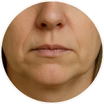 Detailní AI vizualizace dolní části obličeje, okolí úst a brady vytvořená pro online program Facelift Yoga Experience od certifikované lektorky Martiny Bajerové. Slouží k ilustraci zaměření technik pro tuto partii.