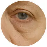 Detailní AI vizualizace vrásek a jemných linek v okolí očí vytvořená pro online program Facelift Yoga Experience od certifikované lektorky Martiny Bajerové.