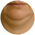 Detailní AI vizualizace oblasti podbradku a krku vytvořená pro online program Facelift Yoga Experience od certifikované lektorky Martiny Bajerové. Slouží k názorné ilustraci zaměření technik.