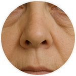 Detailní AI vizualizace střední části tváře, oblasti nosu a nosoretních rýh vytvořená pro online program Facelift Yoga Experience od certifikované lektorky Martiny Bajerové.