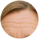 Detailní AI vizualizace vrásek na čele v rámci online programu Facelift Yoga Experience od certifikované lektorky Martiny Bajerové.